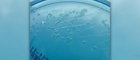 E coli infection