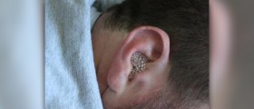 Ear infection in adults