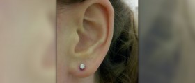 Ear piercing aftercare
