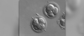 IVF - what to expect from the embryo transfer procedure