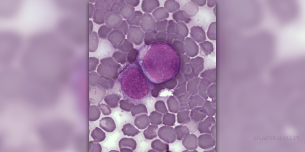 Early signs and symptoms of leukemia | General center | SteadyHealth.com