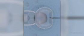 Artificial insemination process