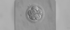 Octuplet mom's IVF doctor scrutinized
