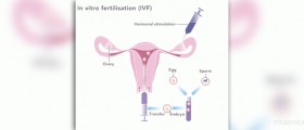 What does unsuccessful IVF have to do with organ transplants?