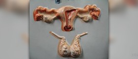 Endocrine benign tumors
