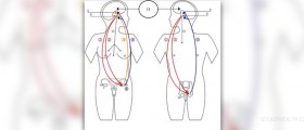 Endocrine system functions and diseases