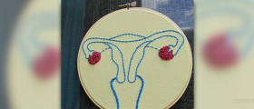 Endometrial cancer diagnosis