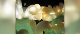 Endometrial polyps treatment