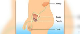 Erectile dysfunction after prostatectomy