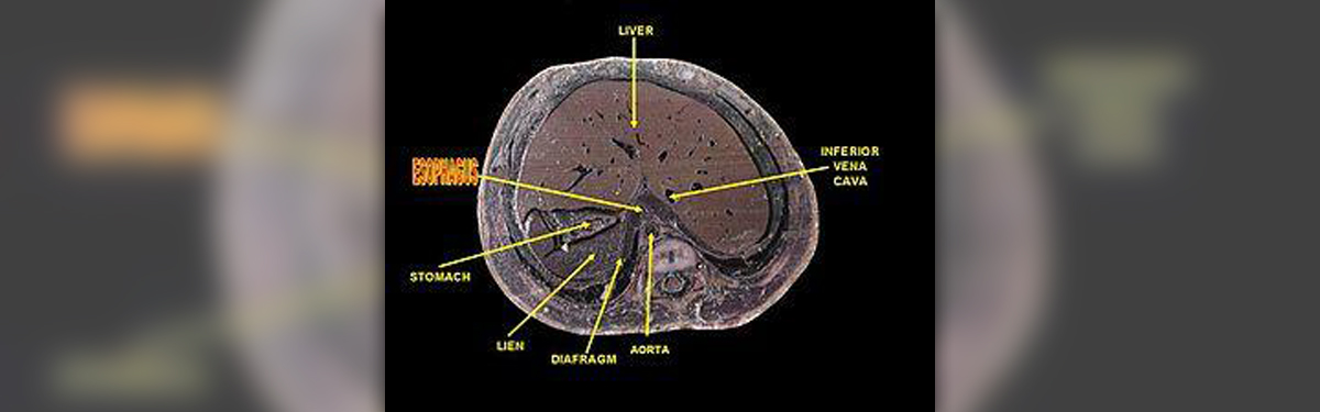 esophageal-cancer-treatment-does-it-spread-quickly-respiratory-tract