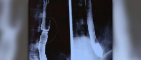 Esophagus function review