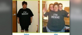 Excess skin after weight loss