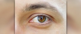 Eye care for dummies