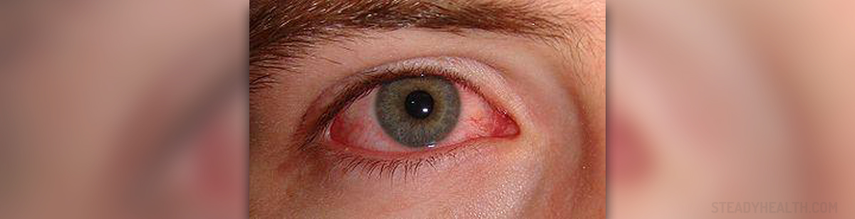 pink eye disease