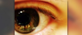 Eye exercises facts