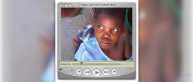 Eye infections in children