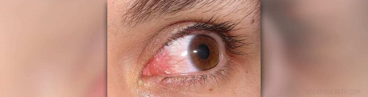 Sinus And Eye Pain On One Side