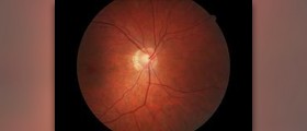 Eye problems diagnosis
