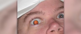 Eye surgery options