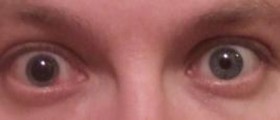 Eye swelling causes and treatment