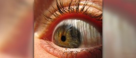 Eye transplant facts