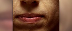 Facial hair removal