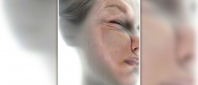 Factors that causes wrinkles