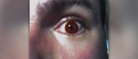 Facts about colored contact lenses