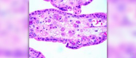 Facts about cytomegalovirus (cmv) during pregnancy