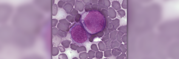 Facts about leukemia