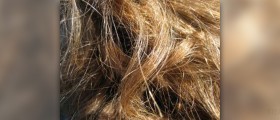 Falling hair home treatment