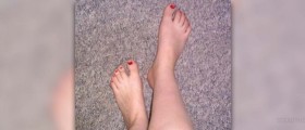 Feet swelling during pregnancy