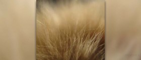Female hair loss solution
