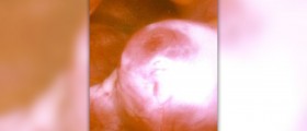 Fertility: What happens during ovulation?