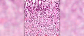 Focusing on lungs health in children