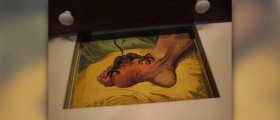 Foods to eat for gout