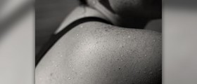 Frozen shoulder symptoms