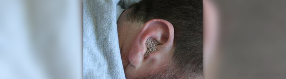 Fungal Ear Infection General Center