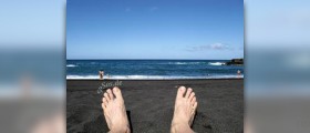 Fungal foot infection