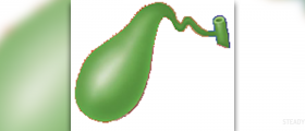 Gallbladder surgery complications