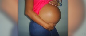 Gallbladder symptoms during pregnancy