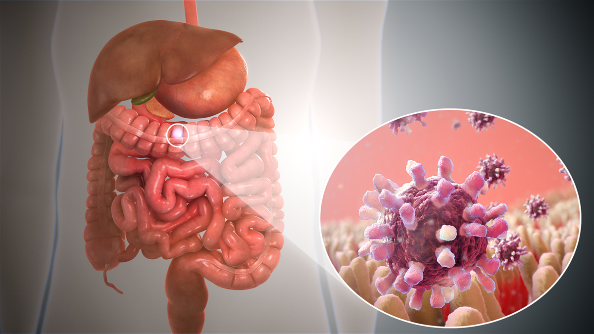 gastroenteritis-symptoms-causes-and-treatment-general-center