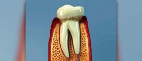 Gingival hyperplasia facts