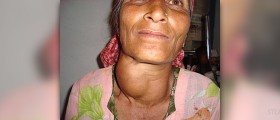 Painful goiter remedy