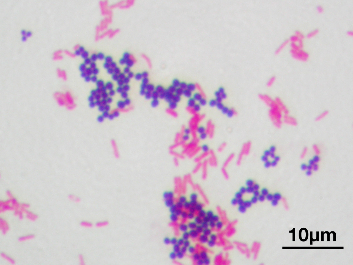 gram negative bacteria list