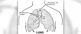 Granulomatous lung disease