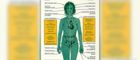 Graves' disease - Overactivity of thyroid hormone production