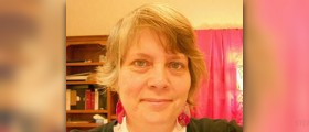 Hair loss in women over 50