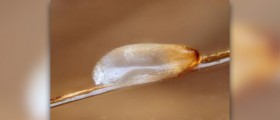 Head lice eggs