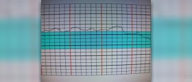 Healthy running heart rate